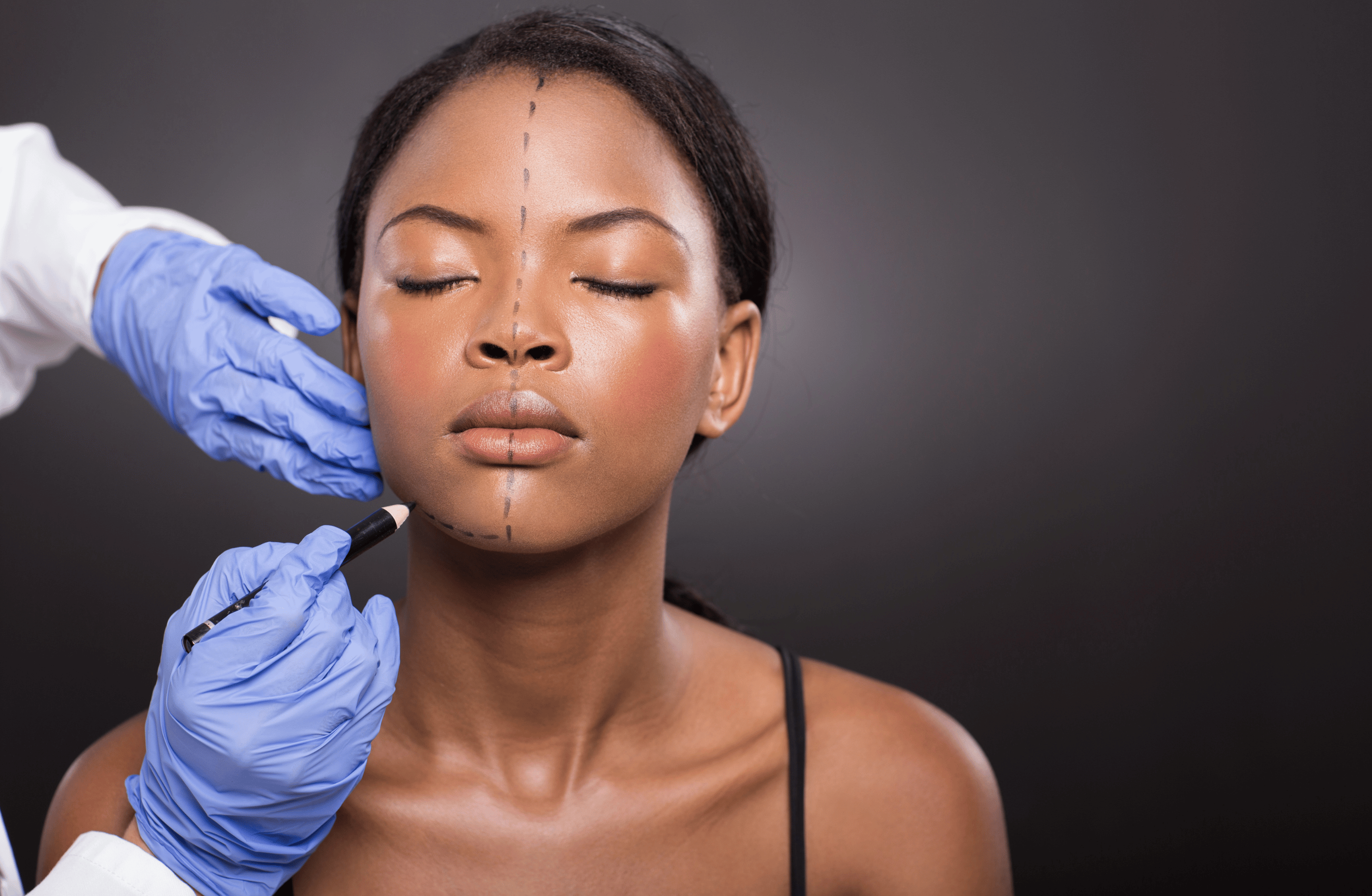 blogs-cirurgias-faciais-xperthealth